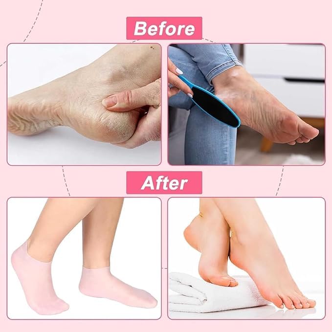Moisturizing Gel Foot Socks - 1 Pair